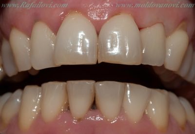 Емах корона